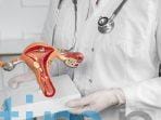 keluhan-tersering-orang-dengan-kanker-serviks-segera-periksakan-ke-dokter-bila-alami-gejala-berikut_3e825bf.jpg